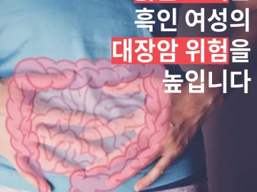 붉은 고기는 흑인 여성의 대장암 위험을 높입니다.