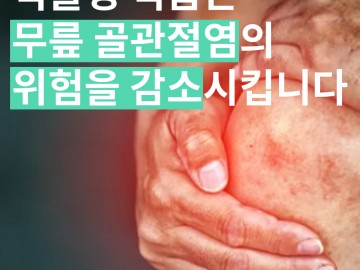 식물성 식품은 무릎골관절염의 위험을 감소시킵니다.